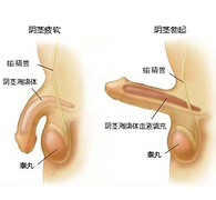 功能性障碍